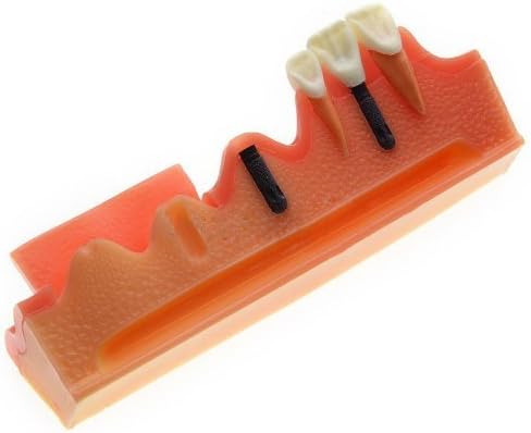 Док.Демонстрация на модел на зъба Royal New Simulation Грижи За практикуване на имплантиране на зъби