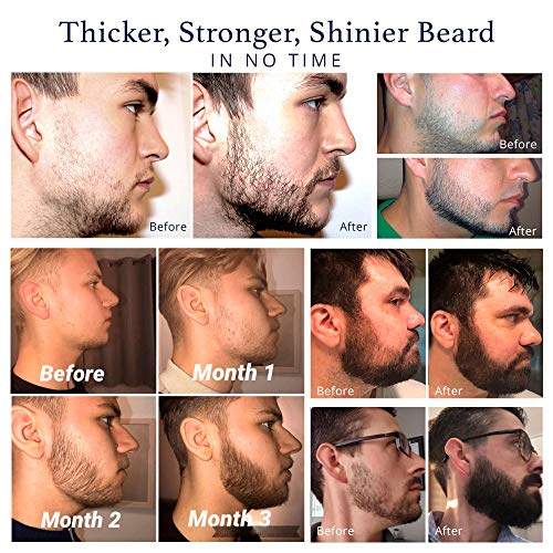 Комплект за растеж на брада с Олио-Серум за растеж на брада и Валяк За Растежа на Брадата - Hair/Средство за Растеж на брада