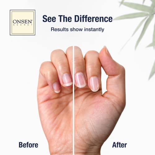Крем за кожичките Onsen, Олио за кожичките на ноктите дълбоко действие - Японската серум и масло за грижа за нокти с натурални лечебни минерали, успокояват, възстановя