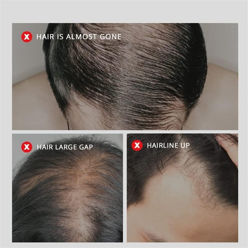 Ефективен серум за растеж на коса, спрей за лечение на косопад, етерично масло, възстановително, питающее корените на косата, възстановително растежа на косата гри?