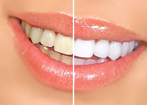 Писалки за избелване на зъбите Dr. Smiles Pop & Prime (3 опаковки)