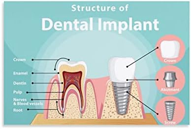 BLUDUG Зъбни Импланти Плакат за Грижа за зъбите Плакат на дентална клиника (7) Платно за Живопис Плакати И Щампи Стенни Художествени Картини за вашия интериор на Хола С