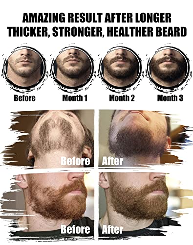 Комплект за растеж на брада, Комплект за оформяне на брада на Ролка за оформяне на брада, 2 пакета Масло За растеж на брада,